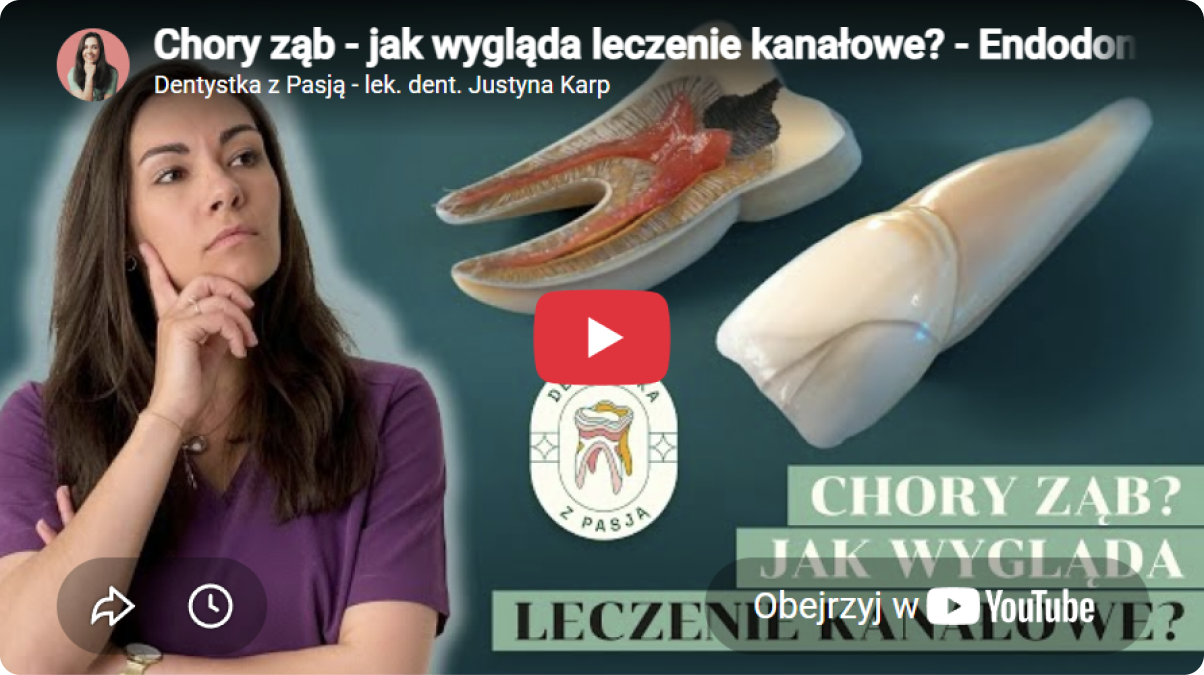 Chory ząb — jak wygląda leczenie kanałowe? Film lek. dent. Justyny Karp